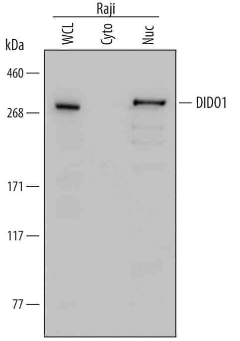 Western Blot DIDO1 Antibody (734823)