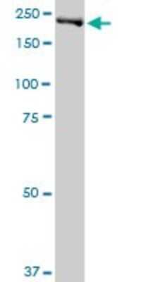 Western Blot: DNMBP Antibody [H00023268-B01P] - Analysis of DNMBP expression in HeLa.