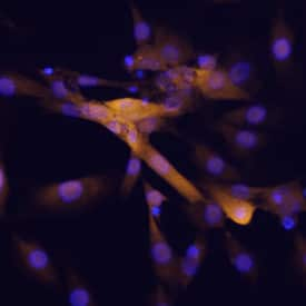 DOK7 was detected in immersion fixed C2C12 mouse myoblast cell line differentiated into myotubes using Mouse Anti-Human DOK7 Monoclonal Antibody (Catalog # MAB6398) at 25 µg/mL for 3 hours at room temperature. Cells were stained using the NorthernLights™ 557-conjugated Anti-Mouse IgG Secondary Antibody (yellow, Catalog # NL007) and counterstained with DAPI (blue). Specific staining was localized to cytoplasm. View our protocol for Fluorescent ICC Staining of Cells on Coverslips.