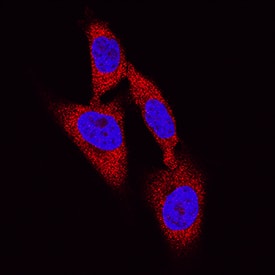 DPP3 was detected in immersion fixed HeLa human cervical epithelial carcinoma cell line using Mouse Anti-Human DPP3 Antigen Affinity-purified Monoclonal Antibody (Catalog # MAB80871) at 8 µg/mL for 3 hours at room temperature. Cells were stained using the NorthernLights™ 557-conjugated Anti-Mouse IgG Secondary Antibody (red; Catalog # NL007) and counterstained with DAPI (blue). Specific staining was localized to cytoplasm. View our protocol for Fluorescent ICC Staining of Cells on Coverslips.