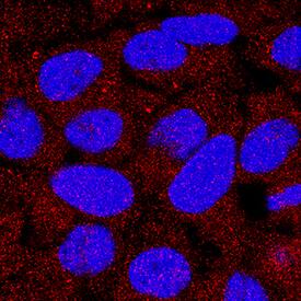 DPP3 was detected in immersion fixed HeLa human cervical epithelial carcinoma cell line using Rat Anti-Human DPP3 Monoclonal Antibody (Catalog # MAB80872) at 8 µg/mL for 3 hours at room temperature. Cells were stained using the NorthernLights™ 557-conjugated Anti-Rat IgG Secondary Antibody (red; Catalog # NL013) and counterstained with DAPI (blue). Specific staining was localized to cytoplasm. View our protocol for Fluorescent ICC Staining of Cells on Coverslips.