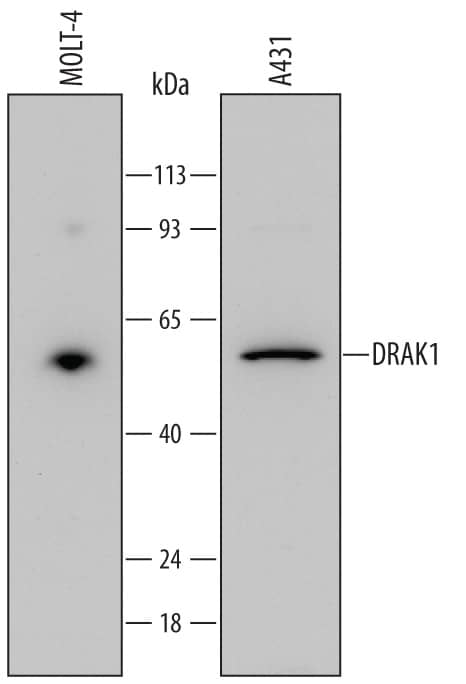 Western blot shows lysates of MOLT-4 human acute lymphoblastic leukemia cell line and A431 human epithelial carcinoma cell line. PVDF Membrane was probed with 1 µg/mL of Mouse Anti-Human DRAK1 Monoclonal Antibody (Catalog # MAB4985) followed by HRP-conjugated Anti-Mouse IgG Secondary Antibody (Catalog # HAF007). A specific band was detected for DRAK1 at approximately 55 kDa (as indicated). This experiment was conducted under reducing conditions and using Immunoblot Buffer Group 2.