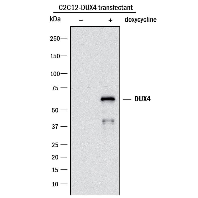 Western blot shows lysates of C2C12 mouse myoblast cell line transfected with human DUX4 untreated (-) or treated (+) with 100 ng/mL Doxycycline for overnight. PVDF membrane was probed with 1 µg/mL of Rabbit Anti-Human DUX4 Monoclonal Antibody (Catalog # MAB95351) followed by HRP-conjugated Anti-Rabbit IgG Secondary Antibody (Catalog # &lt;a class=