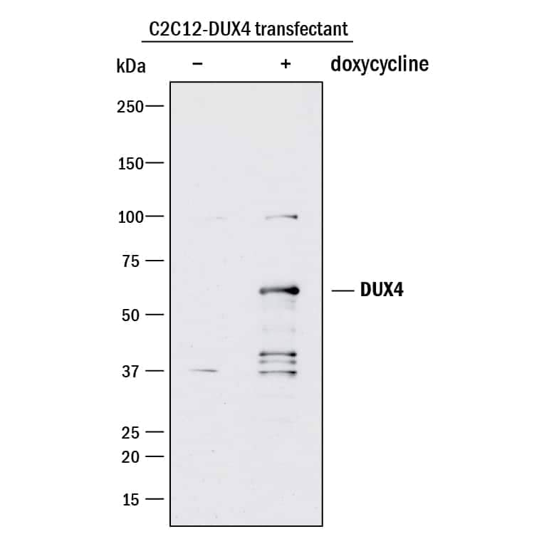 Western blot shows lysates of C2C12 mouse myoblast cell line transfected with human DUX4 untreated (-) or treated (+) with Doxycycline. PVDF membrane was probed with 0.1 µg/mL of Rabbit Anti-Human DUX4 Monoclonal Antibody (Catalog # MAB9535) followed by HRP-conjugated Anti-Rabbit IgG Secondary Antibody (Catalog # HAF008). A specific band was detected for DUX4 at approximately 55 kDa (as indicated). This experiment was conducted under reducing conditions and using Immunoblot Buffer Group 1.