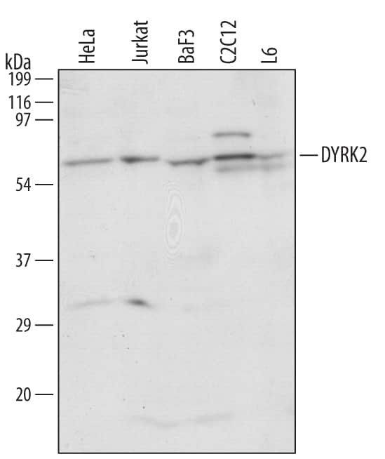 Western blot shows lysates of HeLa human cervical epithelial carcinoma cell line, Jurkat human acute T cell leukemia cell line, BaF3 mouse pro-B cell line, C2C12 mouse myoblast cell line, and L6 rat myoblast cell line. PVDF membrane was probed with 1 µg/mL of Human/Mouse/Rat DYRK2 Antigen Affinity-purified Polyclonal Antibody (Catalog # AF5408) followed by HRP-conjugated Anti-Sheep IgG Secondary Antibody (Catalog # HAF016). Specific bands were detected for DYRK2 at approximately 58 to 62 kDa (as indicated). This experiment was conducted under reducing conditions and using Immunoblot Buffer Group 1.