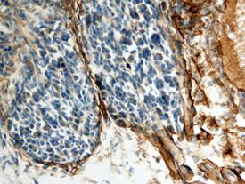 Decorin was detected in perfusion fixed frozen sections of mouse dorsal root ganglia using 15 µg/mL Goat Anti-Mouse Dec-orin Biotinylated Antigen Affinity-purified Polyclonal Antibody (Catalog # BAF1060) overnight at 4 °C. Tissue was stained with the Anti-Goat HRP-DAB Cell & Tissue Staining Kit (brown; Catalog # CTS008) and counter-stained with hematoxylin (blue). View our protocol for Chromogenic IHC Staining of Paraffin-embedded Tissue Sections.