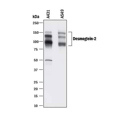 Western blot shows lysates of A431 human epithelial carcinoma cell line and A549 human lung carcinoma cell line. PVDF membrane was probed with 0.5 µg/mL of Mouse Anti-Human Desmoglein-2 Monoclonal Antibody (Catalog # MAB947) followed by HRP-conjugated Anti-Mouse IgG Secondary Antibody (Catalog # HAF018). Specific bands were detected for Desmoglein-2 at approximately 90-160 kDa (as indicated). This experiment was conducted under reducing conditions and using Immunoblot Buffer Group 1.