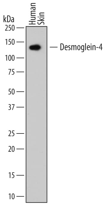 Western blot shows lysates of human skin tissue. PVDF membrane was probed with 2 µg/mL of Mouse Anti-Human Desmoglein-4 Monoclonal Antibody (Catalog # MAB6589) followed by HRP-conjugated Anti-Mouse IgG Secondary Antibody (Catalog # HAF007). A specific band was detected for Desmoglein-4 at approximately 130 kDa (as indicated). This experiment was conducted under reducing conditions and using Immunoblot Buffer Group 1.