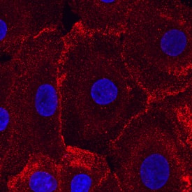 Desmoglein-2 was detected in immersion fixed NHEK human normal epidermal keratinocytes using Mouse Anti-Human Desmoglein-2 Monoclonal Antibody (Catalog # MAB947) at 10 µg/mL for 3 hours at room temperature. Cells were stained using the NorthernLights™ 557-conjugated Anti-Mouse IgG Secondary Antibody (red; Catalog # NL007) and counterstained with DAPI (blue). Specific staining was localized to cytoplasm and cell junctions. View our protocol for Fluorescent ICC Staining of Cells on Coverslips.