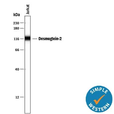 Simple Western lane view shows lysates of Jurkat human acute T cell leukemia cell line, loaded at 0.2 mg/mL. A specific band was detected for Desmoglein‑2 at approximately 120 kDa (as indicated) using 20 µg/mL of Mouse Anti-Human Desmoglein‑2 Monoclonal Antibody (Catalog # MAB947). This experiment was conducted under reducing conditions and using the 12-230 kDa separation system. 