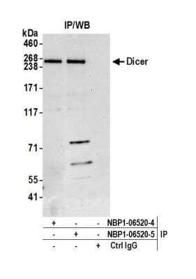 Immunoprecipitation: Dicer Antibody [NBP1-06520] - Detection of human Dicer by western blot of immunoprecipitates. Samples: Whole cell lysate (1.0 mg per IP reaction; 20% of IP loaded) from HEK293T cells prepared using NETN lysis buffer. Antibodies: Affinity purified rabbit anti-Dicer antibody NBP1-06520 (lot NBP1-06520-5) used for IP at 6 ug per reaction. Dicer was also immunoprecipitated by a previous lot of this antibody (lot NBP1-06520-4). For blotting immunoprecipitated Dicer, NBP1-06520 was used at 1 ug/ml. Detection: Chemiluminescence with an exposure time of 10 seconds.