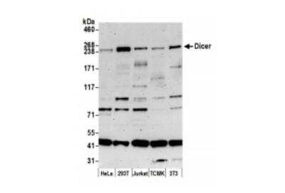 Western Blot: Dicer Antibody [NBP1-06520] - Whole cell lysate (15 ug) from HeLa, 293T, Jurkat, mouse TCMK-1, and mouse NIH3T3 cells prepared using NETN lysis buffer. Antibody: Affinity purified rabbit antiDicer antibody used for WB at 0.1 ug/ml. Detection: Chemiluminescence with an exposure time of 3 minutes.