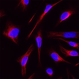 Digoxigenin was detected in immersion fixed HeLa human cervical epithelial carcinoma cell line using Rabbit Anti-Human Digoxigenin Monoclonal Antibody (Catalog # MAB10386) at 1 µg/mL for 3 hours at room temperature. Cells were stained using the NorthernLights™ 557-conjugated Anti-Rabbit IgG Secondary Antibody (red; NL004) and counterstained with DAPI (blue). Specific staining was localized to cytoplasm incubated with Digoxigenin-labeled anti-Vimentin antibody. View our protocol for Fluorescent ICC Staining of Cells on Coverslips.