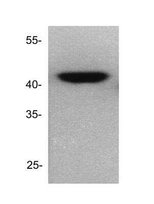 Western Blot: Dnmt2 Antibody [NB200-616] - Homogenized mouse brain cells. Image from verified customer review.