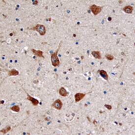 Doc2a was detected in immersion fixed paraffin-embedded sections of human brain (hippocampus) using Mouse Anti-Human Doc2a Monoclonal Antibody (Catalog # MAB7904) at 15 µg/mL overnight at 4 °C. Before incubation with the primary antibody, tissue was subjected to heat-induced epitope retrieval using Antigen Retrieval Reagent-Basic (Catalog # CTS013). Tissue was stained using the Anti-Mouse HRP-DAB Cell & Tissue Staining Kit (brown; Catalog # CTS002) and counterstained with hematoxylin (blue). Specific staining was localized to cytoplasm of neurons. View our protocol for Chromogenic IHC Staining of Paraffin-embedded Tissue Sections.