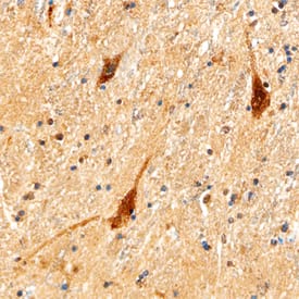 Dopamine D1 R/DRD1 was detected in immersion fixed paraffin-embedded sections of human brain (caudate nucleus) using Mouse Anti-Human Dopamine D1 R/DRD1 Monoclonal Antibody (Catalog # MAB8276) at 15 µg/mL overnight at 4 °C. Tissue was stained using the Anti-Mouse HRP-DAB Cell & Tissue Staining Kit (brown; Catalog # CTS002) and counterstained with hematoxylin (blue). Specific staining was localized to neuronal cytoplasm. View our protocol for Chromogenic IHC Staining of Paraffin-embedded Tissue Sections.