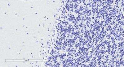 Immunohistochemistry-Paraffin Doublecortin Antibody