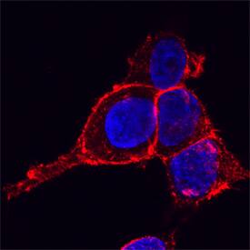 Drebrin 1 was detected in immersion fixed HeLa human cervical epithelial carcinoma cell line using Sheep Anti-Human Drebrin 1 Antigen Affinity-purified Polyclonal Antibody (Catalog # AF7739) at 15 µg/mL for 3 hours at room temperature. Cells were stained using the NorthernLights™ 557-conjugated Anti-Sheep IgG Secondary Antibody (red; Catalog # NL010) and counterstained with DAPI (blue). Specific staining was localized to plasma membranes. View our protocol for Fluorescent ICC Staining of Cells on Coverslips.