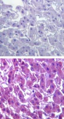 Immunohistochemistry-Paraffin: Dtk/TYRO3 Antibody [NBP2-23725] -  Analysis of TYRO3 in paraffin-embedded formalin-fixed human liver tissue using an isotype control (top) and this antibody (bottom) at 1:100.