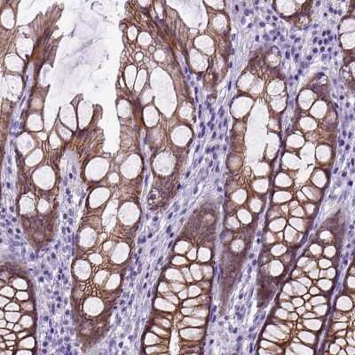 Immunohistochemistry-Paraffin: E-Cadherin Antibody [NBP1-84588] - Staining of human colon shows moderate positivity in plasma membrane in glandular cells.