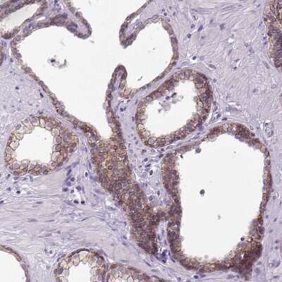 Immunohistochemistry-Paraffin: E-Cadherin Antibody [NBP1-84588] - Staining of human prostate shows moderate positivity in plasma membrane in glandular cells.