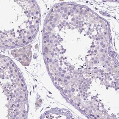 Immunohistochemistry-Paraffin: E-Cadherin Antibody [NBP1-84588] - Staining of human testis shows no positivity in cells in seminiferous ducts as expected.