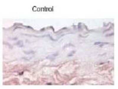 Immunohistochemistry-Paraffin: E-Selectin/CD62E Antibody [NBP1-45545] - Staining of aorta paraffin section from obese diabetic mice. Staining of Endothelial cell lair has been observed.