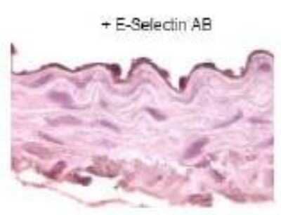Immunohistochemistry-Paraffin: E-Selectin/CD62E Antibody [NBP1-45545] - Staining of aorta paraffin section from obese diabetic mice. Staining of Endothelial cell lair has been observed.