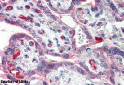 Immunohistochemistry-Paraffin: E-Selectin/CD62E Antibody [NBP1-45545] - Formalin fixed, paraffin-embedded tissue after heat induced antigen retrieval. 5 ug/ml of antibody used for staining. After incubation with the primary antibody, slides were incubated with biotinylated secondary antibody, followed by alkaline phosphatase-streptavidin and chromogen.