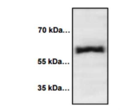 Western Blot: E-Selectin/CD62E Antibody [NBP1-45545] - Jurkat cell lysate (80 ug) loaded Blocking/Dilution buffer: 5% NFDM (1 hr at RT) / TBST E-Selectin Polyclonal Antibody used at 1:1000 dilution - O/N at 4 degrees C. Goat Anti-Rabbit IgG peroxidase conjugated used at 1:10,000 dilution - 1 hr at RT