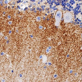     EAAT1/GLAST‑1  was detected in immersion fixed paraffin-embedded sections of human brain  (cerebellum) tissue using Mouse Anti-Human EAAT1/GLAST‑1  Monoclonal Antibody (Catalog # MAB6048) at 5 µg/mL for 1  hour at room temperature followed by incubation with the Anti-Mouse IgG  VisUCyte™ HRP Polymer Antibody (Catalog # VC001).  Before incubation with the primary antibody, tissue was subjected to  heat-induced epitope retrieval using Antigen Retrieval Reagent-Basic (Catalog  # CTS013).  Tissue was stained using DAB (brown) and counterstained with hematoxylin  (blue). Specific staining was localized to neuronal puncta in molecular layer  . View our protocol for IHC  Staining with VisUCyte HRP Polymer Detection Reagents. 