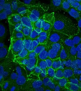 E-Cadherin was detected in immersion fixed PANC-1 human pancreatic carcinoma cell line using Mouse Anti-Human E-Cadherin Monoclonal Antibody (Catalog # MAB18383) at 10 µg/mL for 3 hours at room temperature. Cells were stained using the NorthernLights™ 493-conjugated Anti-Mouse IgG Secondary Antibody (green; Catalog # NL009) and counterstained with DAPI (blue). Specific staining was localized to plasma membrane. View our protocol for Fluorescent ICC Staining of Cells on Coverslips.