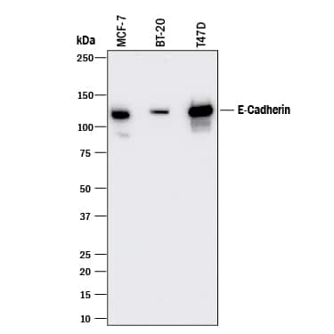 Western blot shows lysates of MCF-7 human breast cancer cell line, BT-20 human breast cancer cell line, and T47D human breast cancer cell line. PVDF membrane was probed with 0.5 µg/mL of Mouse Anti-Human E-Cadherin Monoclonal Antibody (Catalog # MAB18383) followed by HRP-conjugated Anti-Mouse IgG Secondary Antibody (Catalog # HAF018). A specific band was detected for E-Cadherin at approximately 120 kDa (as indicated). This experiment was conducted under reducing conditions and using Immunoblot Buffer Group 1.
