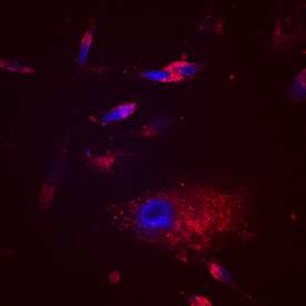 EDIL3 was detected in immersion fixed MDA-MB-231 human breast cancer cell line using Sheep Anti-Human EDIL3 Antigen Affinity-purified Polyclonal Antibody (Catalog # AF6046) at 10 µg/mL for 3 hours at room temperature. Cells were stained using the NorthernLights™ 557-conjugated Anti-Sheep IgG Secondary Antibody (red; Catalog # NL010) and counterstained with DAPI (blue). Specific staining was localized to cytoplasm. View our protocol for Fluorescent ICC Staining of Cells on Coverslips.