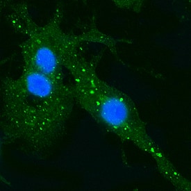 EEA1 was detected in formaldehyde fixed HeLa human cervical epithelial carcinoma cell line using Sheep Anti-Human/Mouse/Rat EEA1 Alexa Fluor® 488‑conjugated Antigen Affinity-purified Polyclonal Antibody (Catalog # IC8047G) at 1:10 dilution overnight at 4 °C and counterstained with DAPI (blue). Specific staining was localized to endosomes. View our protocol for Fluorescent ICC Staining of Cells on Coverslips.