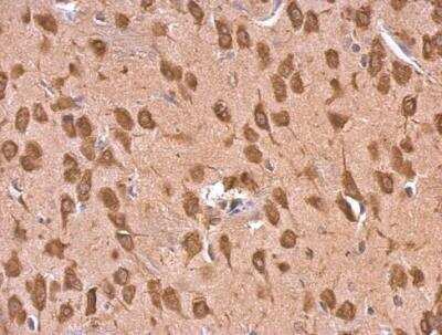 Immunohistochemistry-Paraffin: EEF1A2 Antibody [NBP1-32555] - Paraffin-embedded rat fore brain. EEF1A2 antibody [C1C3] dilution: 1:500.