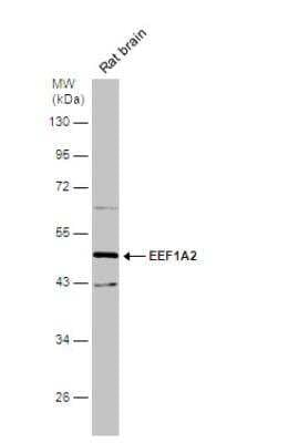 Western Blot: EEF1A2 Antibody [NBP1-32555] - Rat tissue extract (50 ug) was separated by 10% SDS-PAGE, and the membrane was blotted with EEF1A2 antibody [C1C3] diluted at 1:1000. The HRP-conjugated anti-rabbit IgG antibody (NBP2-19301) was used to detect the primary antibody.