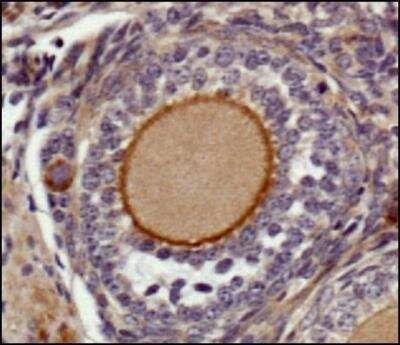 Immunohistochemistry-Paraffin: EGF Antibody [NBP1-19806] - Staining of cells surrounding a follicle and the cytoplasm of the follicle using anti-EGF antibody.