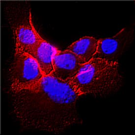EGFR was detected in unfixed live A431 human epithelial carcinoma cell line using Human Anti-Human EGFR (Research Grade Cetuximab Biosimilar) Biotinylated Monoclonal Antibody (Catalog # FAB9577B) at 25 µg/mL for 3 hours at room temperature. Cells were stained using the NorthernLights™ 557-conjugated Streptavidin (red; Catalog # NL999) and counterstained with DAPI (blue). Specific staining was localized to plasma membrane and cytoplasm. View our protocol for Fluorescent ICC Staining of Cells on Coverslips.