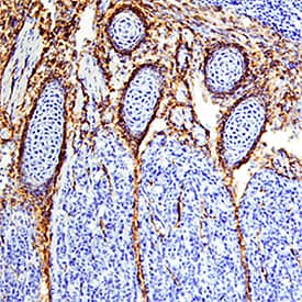 EGFR was detected in immersion fixed frozen sections of mouse embryo (13 d.p.c.) using Goat Anti-Mouse EGFR Biotinylated Antigen Affinity-purified Polyclonal Antibody (Catalog # BAF1280) at 15 µg/mL overnight at 4 °C. Tissue was stained using the Anti-Goat HRP-DAB Cell & Tissue Staining Kit (brown; Catalog # CTS008) and counterstained with hematoxylin (blue). Specific staining was localized to developing muscle. View our protocol for Chromogenic IHC Staining of Frozen Tissue Sections.