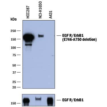 Western blot shows lysates of HCC827 human non-small cell lung cancer cell line, HCT-116 human colorectal carcinoma cell line, and A431 human epithelial carcinoma cell line. PVDF membrane was probed with 2 µg/mL of Mouse Anti-Human EGFR (aa 746-750 deletion) Monoclonal Antibody (Catalog # MAB8336) followed by HRP-conjugated Anti-Mouse IgG Secondary Antibody (Catalog # HAF018). A specific band was detected for EGFR (aa 746-750 deletion) at approximately 170 kDa (as indicated). For additional reference total EGFR was detected using Goat Anti-Human EGFR Antigen Affinity-purified Polyclonal Antibody (lower panel, Catalog # AF231). This experiment was conducted under reducing conditions and using Immunoblot Buffer Group 1.