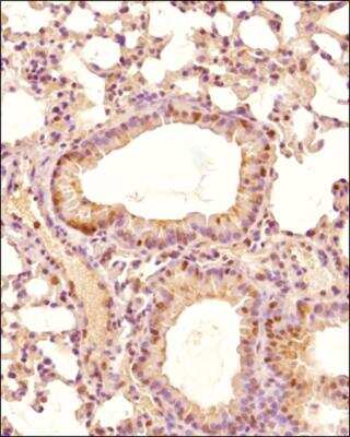 Immunohistochemistry-Paraffin: EGLN1/PHD2 Antibody [NB100-2219] - Analysis of a FFPE mouse lung section using 1:200 dilution of EGLN1/PHD2 antibody. The staining was developed using HRP conjugated anti-rabbit secondary antibody and DAB reagent. The antibody generated a specific staining in the cytoplasm and nuclei of alveolar as well as bronchiolar epithelial cells. Cytoplasmic staining was observed in almost all cells while the nuclear positivity was seen in a subset of cells only.