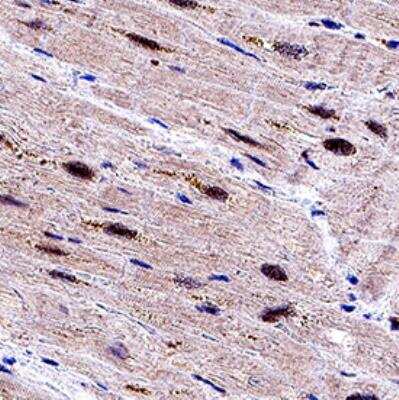 Immunohistochemistry: EGLN3/PHD3 Antibody [NB100-303] - PHD3 was detected in immersion fixed paraffin-embedded sections of human heart using Rabbit Anti-Human EGLN3 polyclonal Antibody (NB100-303) at 5 ug/mL for 1 hour at room temperature followed by incubation with the Anti-Rabbit IgG VisUCyte(TM) HRP Polymer Antibody (VC003). Tissue was stained using DAB (brown) and counterstained with hematoxylin (blue). Specific staining was localized to nuclei.