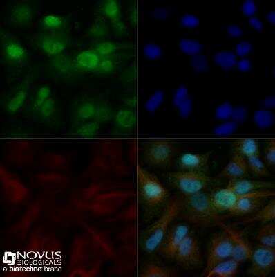 Immunocytochemistry/Immunofluorescence: EGR2 Antibody [NB100-92327] - HepG2 cells were fixed for 10 minutes using 10% formalin and then permeabilized for 5 minutes using 1X TBS + 0.5% Triton-X100. The cells were incubated with anti-EGR2 at 5ug/ml overnight at 4C and detected with an anti-rabbit Dylight 488 (Green) at a 1:500 dilution. Alpha tubulin (DM1A) NB100-690 was used as a co-stain at a 1:1000 dilution and detected with an anti-mouse Dylight 550 (Red) at a 1:500 dilution. Nuclei were counterstained with DAPI (Blue). Cells were imaged using a 40X objective. 