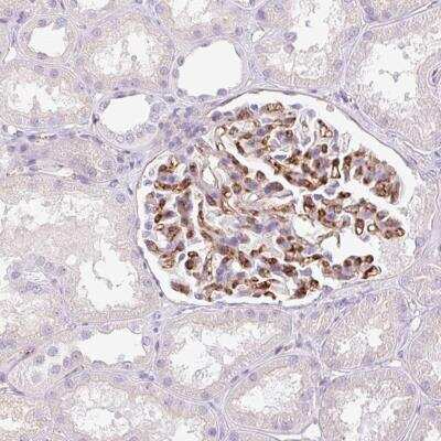 Immunohistochemistry-Paraffin: EHD3 Antibody [NBP2-31896] - Staining of human kidney shows strong cytoplasmic positivity in cells in glomeruli.