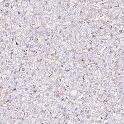 Immunohistochemistry-Paraffin: EHD3 Antibody [NBP2-31896] - Staining of human liver shows moderate membranous positivity in hepatic sinusoid cells.