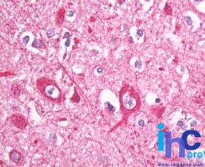 Immunohistochemistry-Paraffin: EIF3B Antibody [NBP2-24571] - Formalin-fixed, paraffin-embedded human brain tissue stained with eIF3B antibody at 10 ug/ml. Staining of formalin-fixed tissues is enhanced by boiling tissue sections in 10 mM sodium citrate buffer, pH 6.0 for 10-20 min followed by cooling at RT for 20 min.
