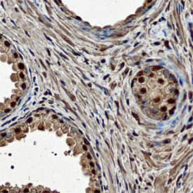 ELF3 was detected in immersion fixed paraffin-embedded sections of human prostate using Mouse Anti-Human ELF3 Monoclonal Antibody (Catalog # MAB57871) at 15 µg/mL overnight at 4 °C. Before incubation with the primary antibody, tissue was subjected to heat-induced epitope retrieval using Antigen Retrieval Reagent-Basic (Catalog # CTS013). Tissue was stained using the Anti-Mouse HRP-DAB Cell & Tissue Staining Kit (brown; Catalog # CTS002) and counterstained with hematoxylin (blue). Specific staining was localized to nuclei of glandular epithelial cells. View our protocol for Chromogenic IHC Staining of Paraffin-embedded Tissue Sections.