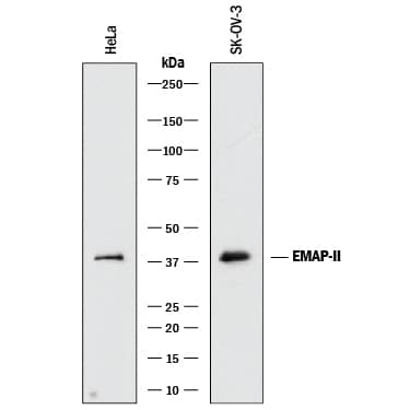 Western blot shows lysates of HeLa human cervical epithelial carcinoma cell line and SK-OV-3 human ovarian adenocarcinoma cell line. PVDF membrane was probed with 0.5 µg/mL of Goat Anti-Human EMAP-II Antigen Affinity-purified Polyclonal Antibody (Catalog # AF1910) followed by HRP-conjugated Anti-Goat IgG Secondary Antibody (Catalog # HAF017). A specific band was detected for EMAP-II at approximately 38 kDa (as indicated). This experiment was conducted under reducing conditions and using Immunoblot Buffer Group 1.