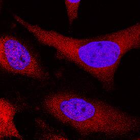 EMAP-II was detected in immersion fixed HeLa human cervical epithelial carcinoma cell line using Mouse Anti-Human/Mouse/ Rat EMAP-II Monoclonal Antibody (Catalog # MAB1910) at 8 µg/mL for 3 hours at room temperature. Cells were stained using the NorthernLights™ 557-conjugated Anti-Mouse IgG Secondary Antibody (red; Catalog # NL007) and counterstained with DAPI (blue). Specific staining was localized to cytoplasm and nuclei. View our protocol for Fluorescent ICC Staining of Cells on Coverslips.